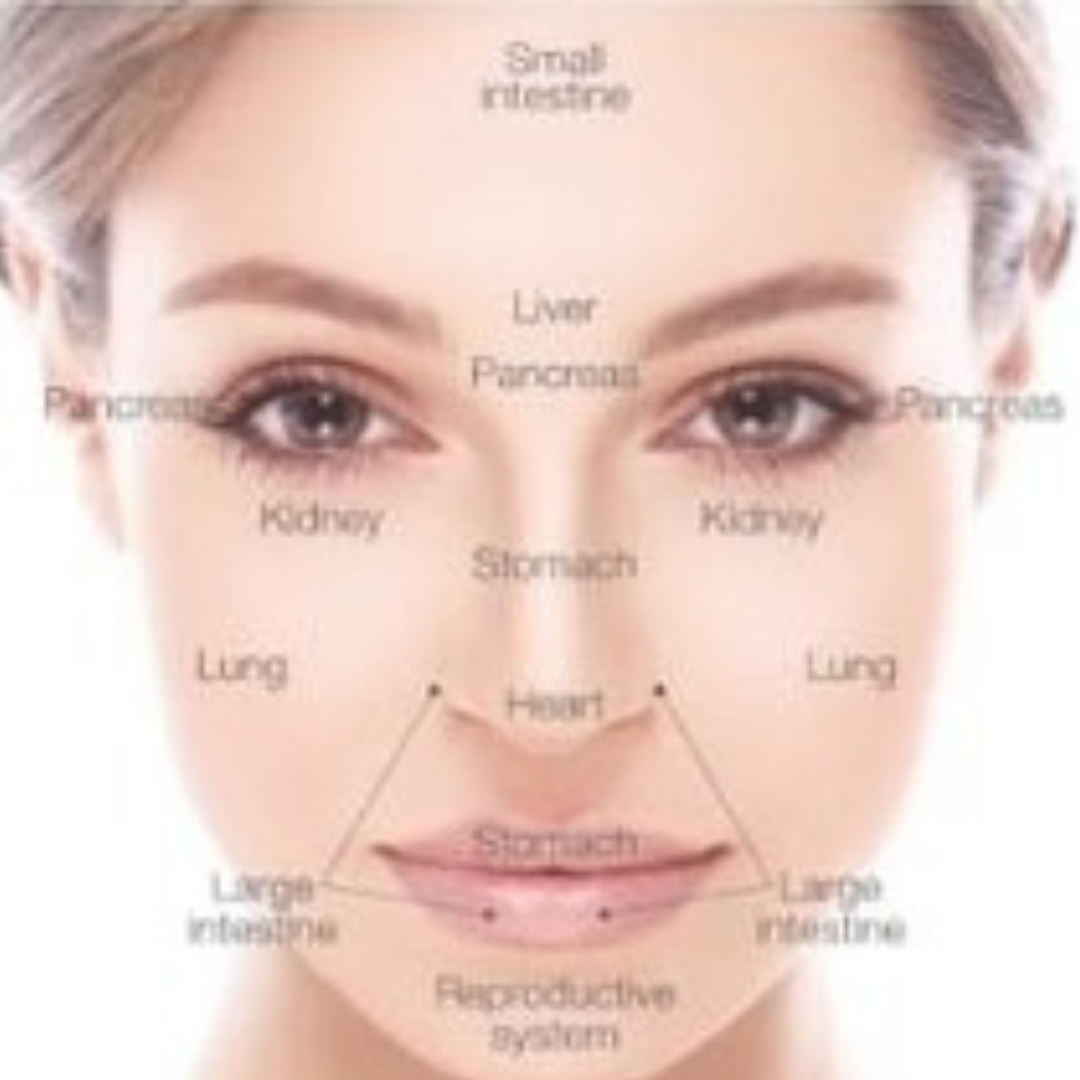 Face mapping for acne